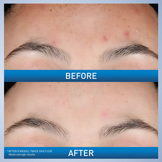 CeraVe resurfacing retinol