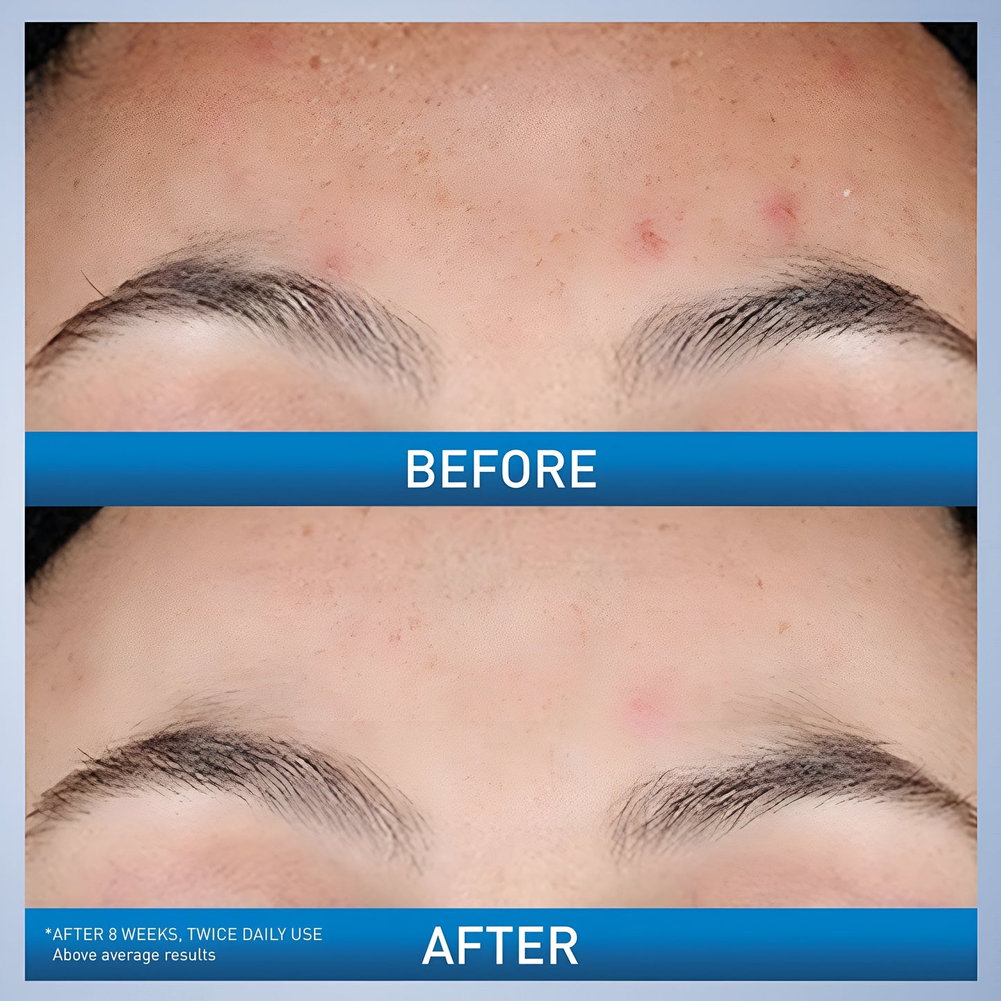 CeraVe Resurfacing Retinol Serum